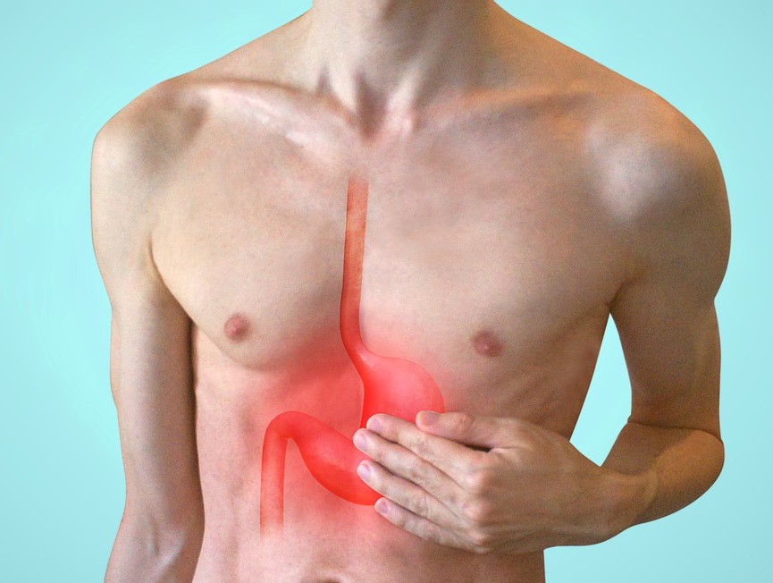 Acid Reflux Pic for Services Page of Website